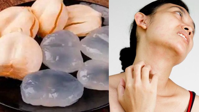 Ice Apple Health Benefits In Hindi: Tadgola Khane Ke Fayde, Weight Loss से लेकर Live Detox|Boldsky