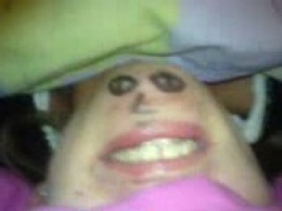 Chin man
