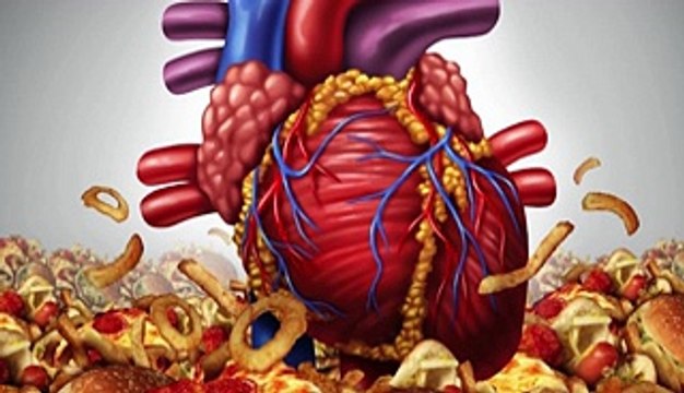What is Heart Attack In this video, we explain what a heart attack is, its common symptoms, and the critical steps you need to take if you or someone you know is experiencing one. Learn about the risk factors, prevention tips, and treatment options to st