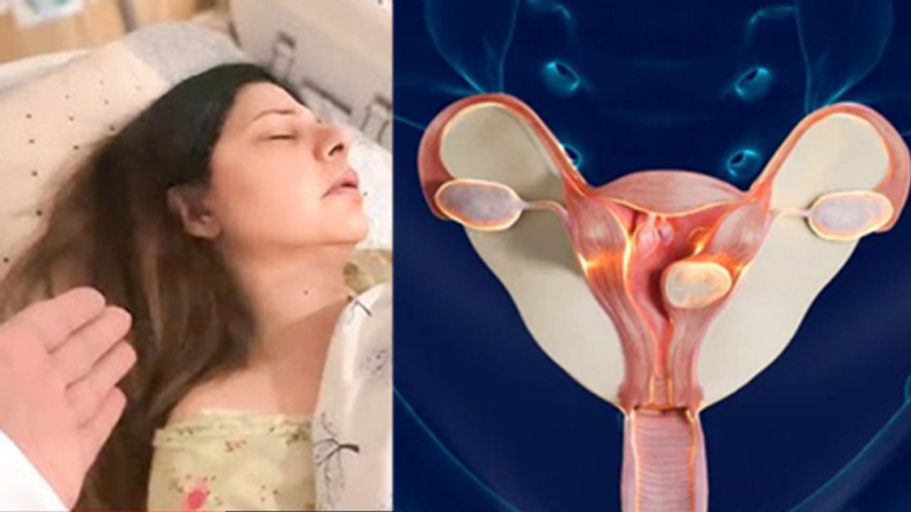 Sambhavna Seth Uterine Polyps Removal Recovery...