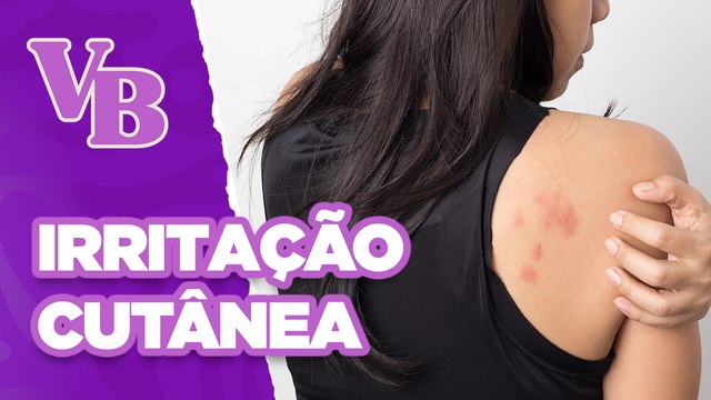 URTICÁRIA: seus tipos, causas e tratamentos - Você Bonita (10/06/2024)