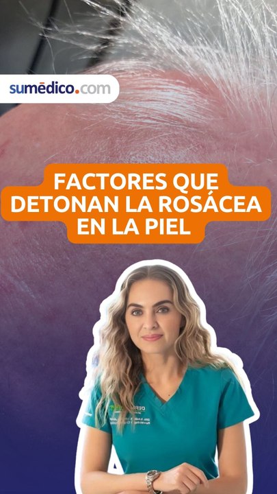 Factores que detonan la rosácea en la piel
