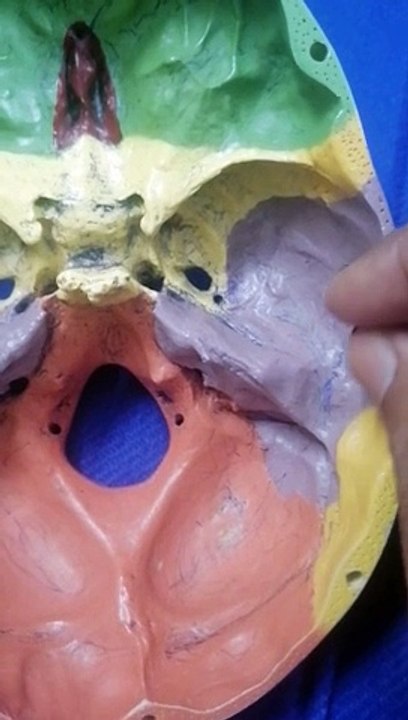 Middle Cranial Fossa