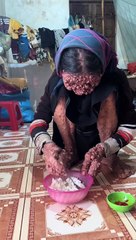 Plz give penny of dollars for her treatment in payeer P1104476522