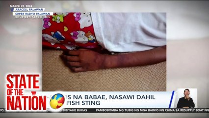 State of the Nation: JELLYFISH STING; TIP TALK: ANO ANG GAGAWIN KAPAG NADIKITAN NG DIKYA?