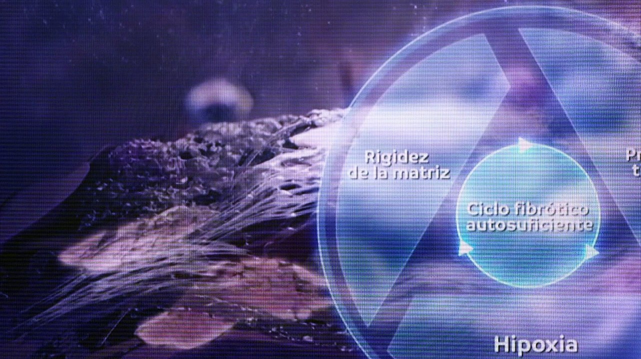 Neumólogos impulsan la formación en EPID en el 57º congreso de SEPAR