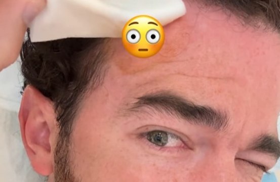 Kevin Jonas has been treated for skin cancer