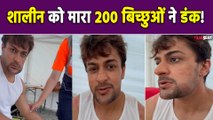 KKK14: Shalin Bhanot का 200 बिच्छू के डंक से हुआ बुरा हाल, Body पर आई Swelling, क्यों हुए Troll!