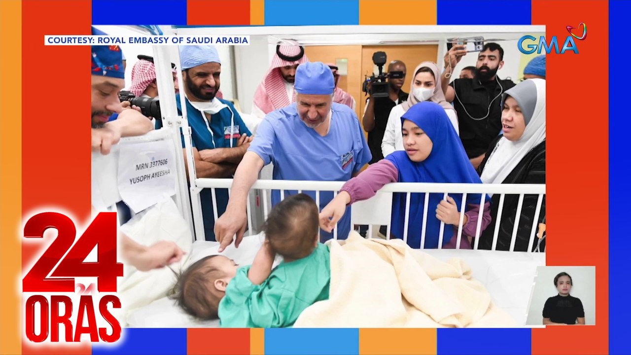 Ikalawang Pinoy conjoined twins na napaghiwalay sa Saudi Arabia, on the road to recovery na | 24 Oras
