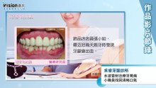 水波雷射治療牙周病 小職員找回清晰口氣｜禾睿牙醫診所 - 作品節錄｜遠大整合行銷