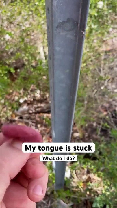 What did you do with your tongue today_ #medical #health #winter