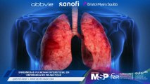 Enfermedad pulmonar intersticial en enfermedades reumáticas y terapia CAR-T