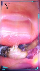 Crushing Blueberry at 1500fps _ Slow Motion