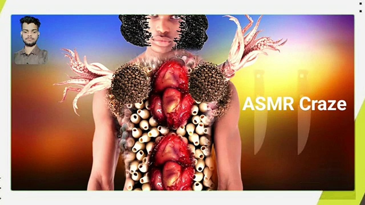 Asmr men body maggots removal video | asmr | asmr animation