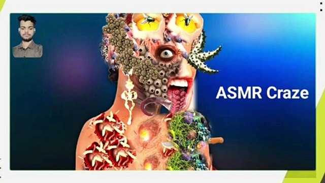 ASMR Removal worms and maggots _ asmr _ asmr animation