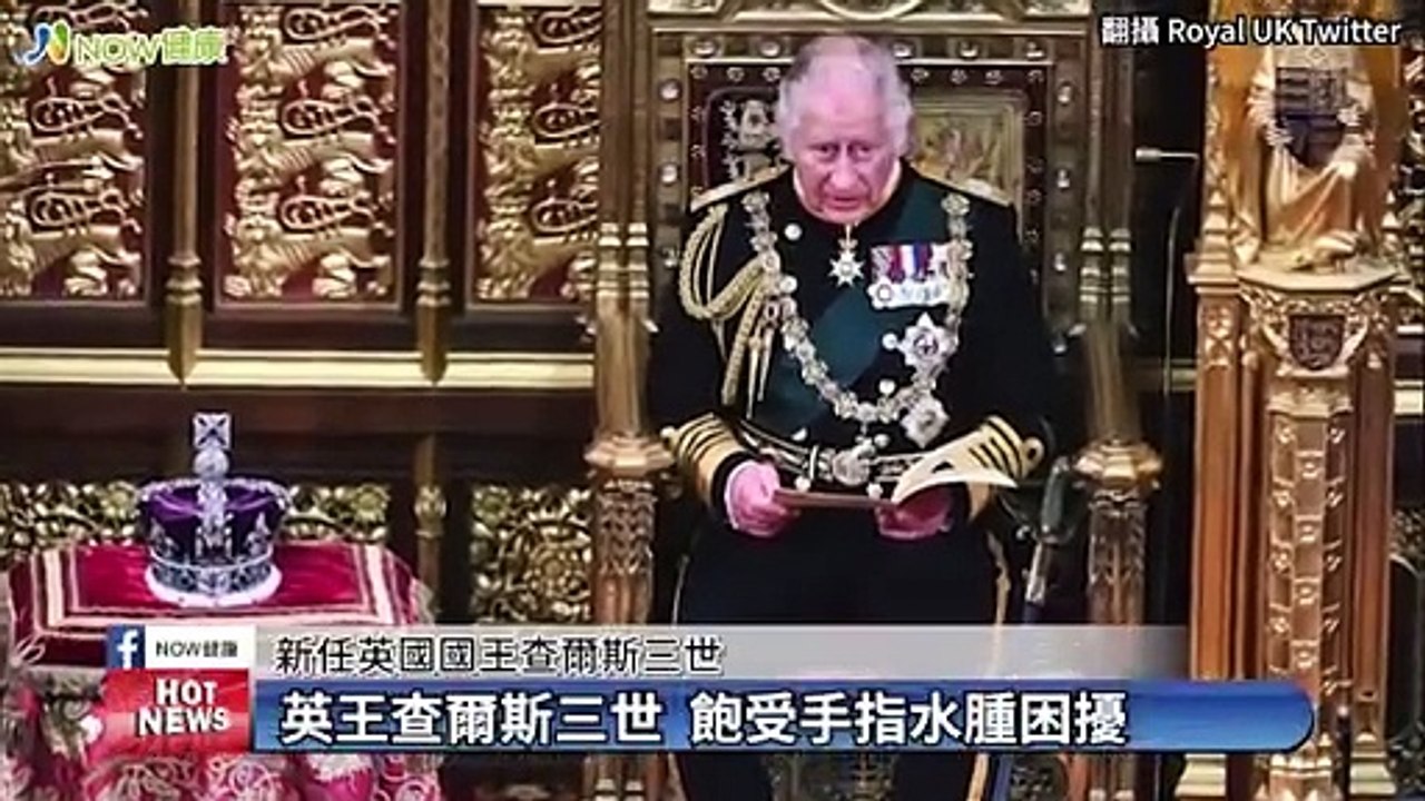 英王查爾斯三世「香腸手指」引關注 醫揭3種可能原因 #NOW健康 #查爾斯三世 #香腸手指