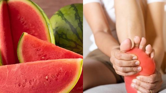 यूरिक एसिड में तरबूज खा सकते है |High Uric Acid Me Tarbuj Khana Chahiye Ya Nahi |Boldsky