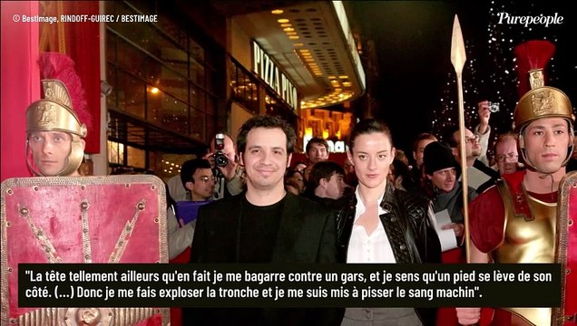 Alexandre Astier blessé, le visage abîmé, quelques heures avant la naissance de sa fille Ariane