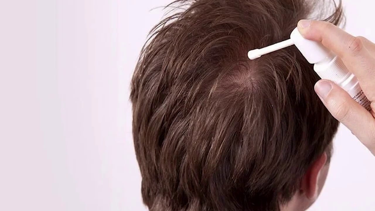 How to regrow your Hair اپنے بالوں کو دوبارہ اگائیں