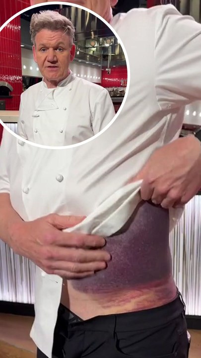 Gordon Ramsay 'lucky' to be alive after horrific bike accident
