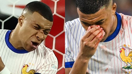 Mbappé se rompe la nariz en el partido entre Francia y Austria de la Eurocopa 2024