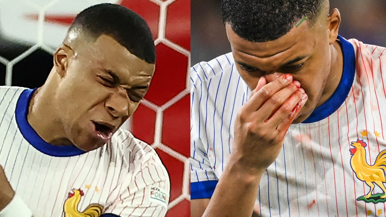 Mbappé se rompe la nariz en el partido entre Francia y Austria de la Eurocopa 2024