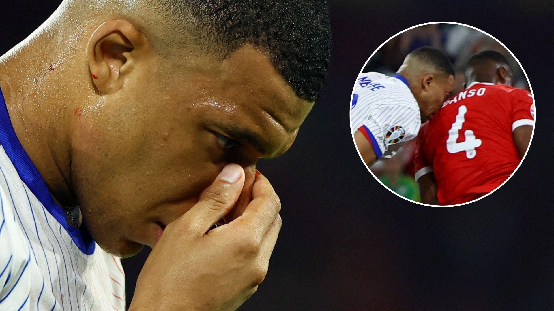 Deschamps Gives Details About Mbappé