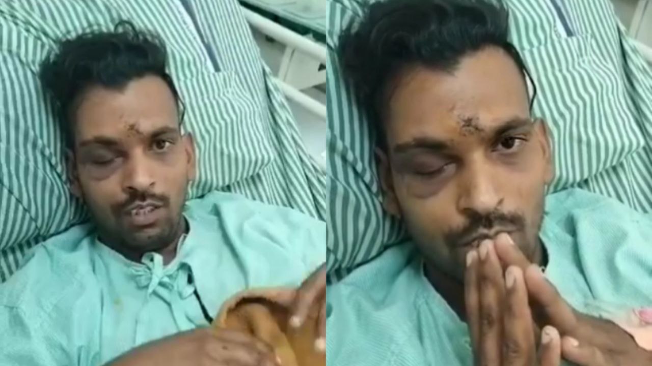शिवखोड़ी-कटरा मार्ग पर बस पर आतंकवादी हमला: अस्पताल ने घायल का उपचार करने से किया इंकार