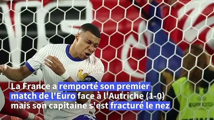 Euro de football: les Bleus inquiets après la fracture du nez de Mbappé