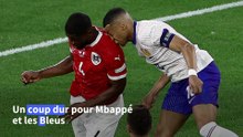 Euro de football: les Bleus inquiets après la fracture du nez de Mbappé