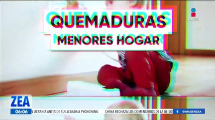 Quemaduras en el hogar, ¿cómo prevenirlas?