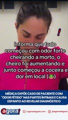 MÉDICA EXPÕE CASO DE PACIENTE COM "ODOR FÉTIDO" NAS PARTES ÍNTIMAS E CAUSA ESPANTO AO REVELAR DIAGNÓSTICO