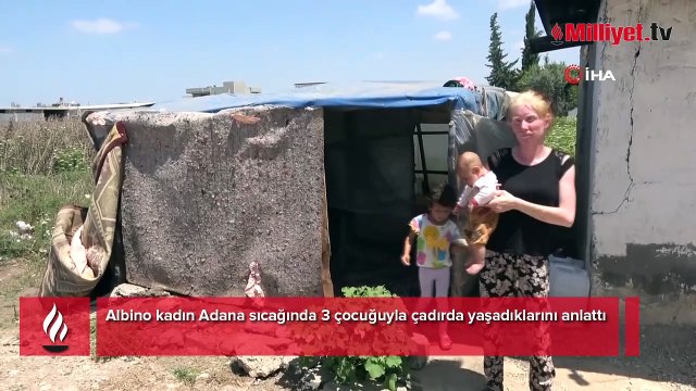 Albino kadın Adana sıcağında 3 çocuğuyla çadırda yaşadıklarını anlattı