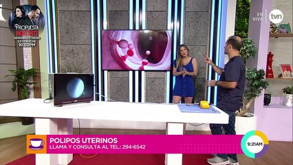 Cita médica: ¿Qué son los pólipos uterinos?