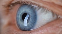 Cambiar El Color De Los Ojos: ¿Cuáles Son Los Riesgos?