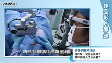白內障一定要手術嗎？如何挑選人工水晶體？｜奧斯卡眼科診所 - 作品節錄｜遠大整合行銷
