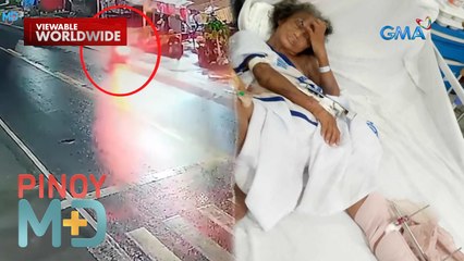 Babae, nasagasaan ng humaharurot na motor | Pinoy MD