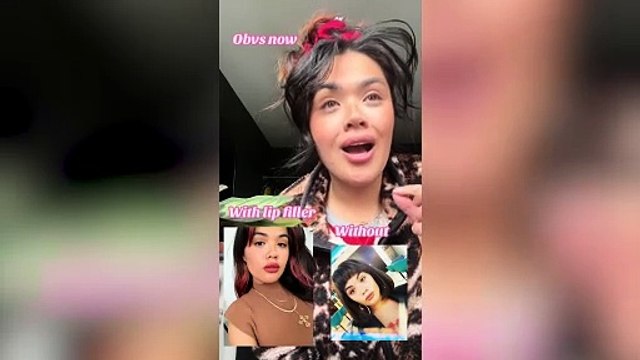 I had lip fillers to look like a Kardashian but now I have saggy lips