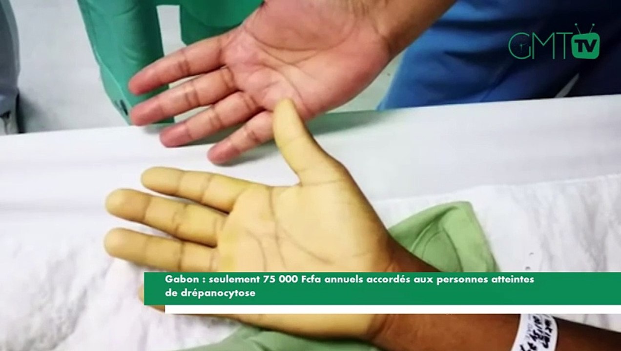 [#Reportage] Gabon : seulement 75 000 Fcfa annuel accordé aux personnes atteintes de drépanocytose