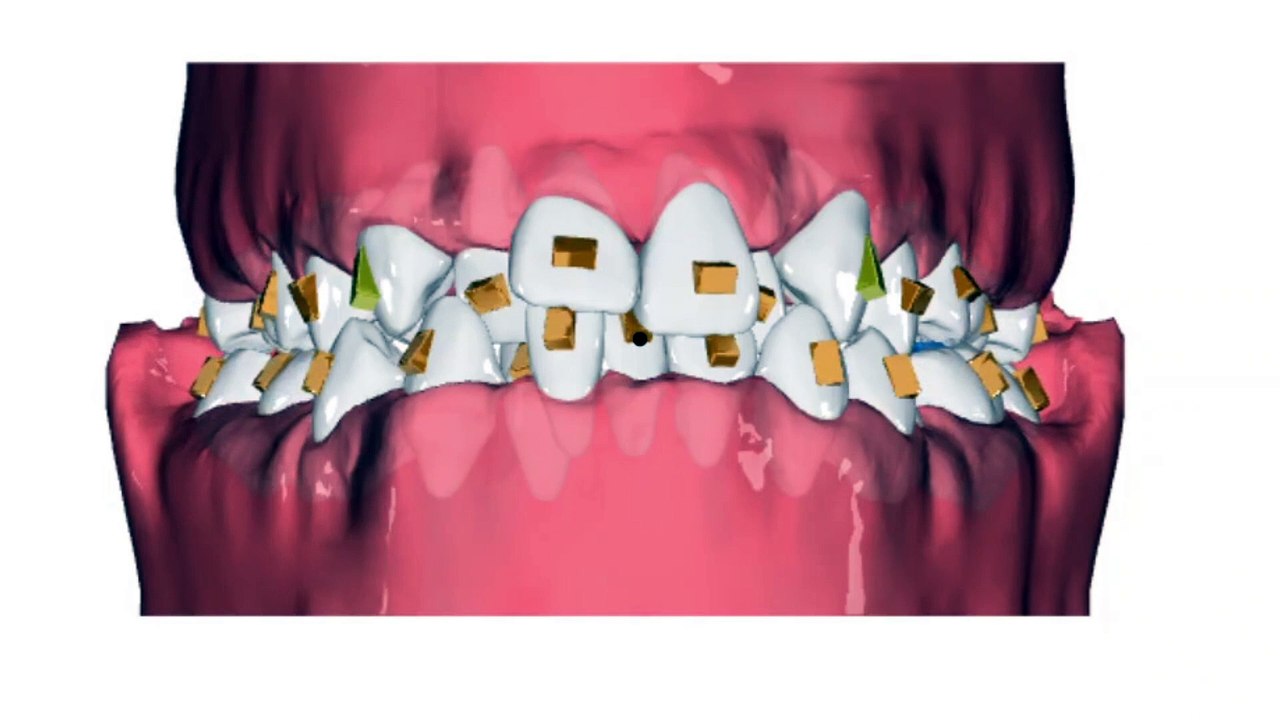 aws50003