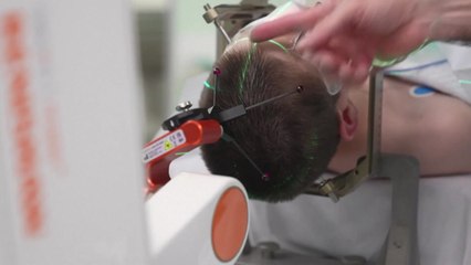 뇌전증 환자 뇌에 세계 첫 신경자극장치 이식..."발작 80%↓" / YTN