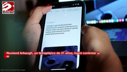 Primer paciente equipado con la interfaz cerebro-computadora Neuralink insiste en que está 'rota'