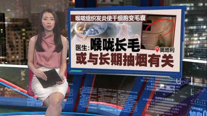 长期每日一包烟30年，男子喉咙竟长出黑色毛发🚬