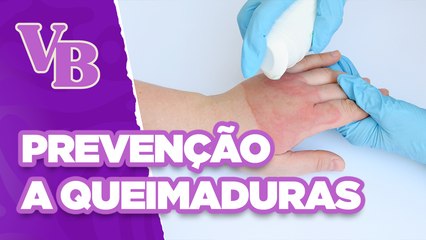 Como se prevenir de ACIDENTES com QUEIMADURAS - Você Bonita (26/06/2024)