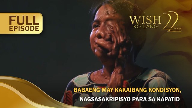 Babaeng may kakaibang kondisyon, nagsasakripisyo para sa kapatid (Full Episode) | Wish Ko Lang