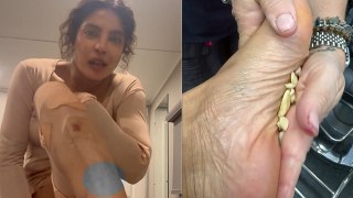 Priyanka Chopra Rubs Garlic On Foot Reason, Explain Garlic Benefits To Fans Post Viral | Boldsky