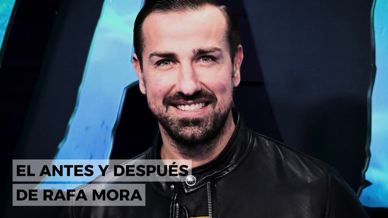 El antes y después de Rafa Mora