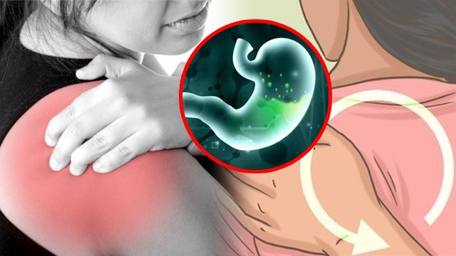 Gas Shoulder Pain Relief: Kandhe Me Gas Ka Ilaj | Gas Se Kandhe Me Dard Ka Ilaj | Boldsky