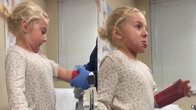 Brave young girl reacts to her cast being removed!