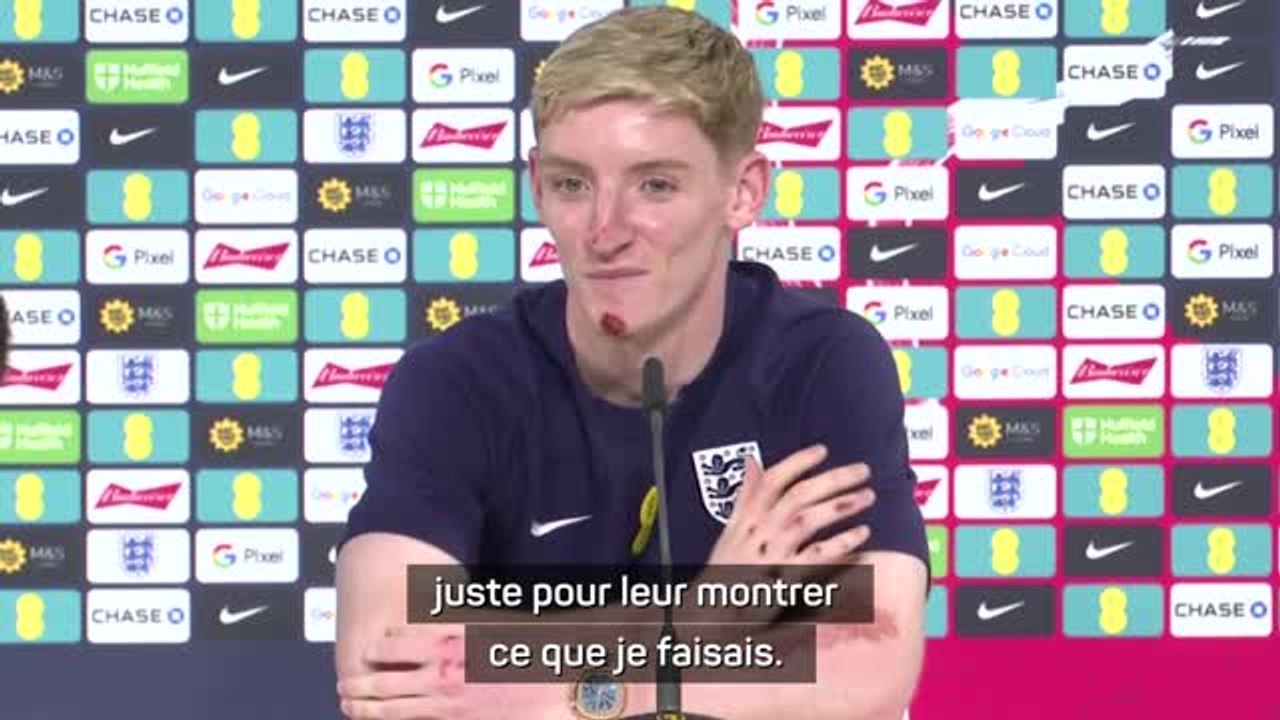 Angleterre - Gordon a chuté à vélo : "J'ai fait un vol plané !"